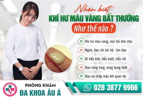 Huyết trắng màu vàng cẩn thận viêm nhiễm phụ khoa
